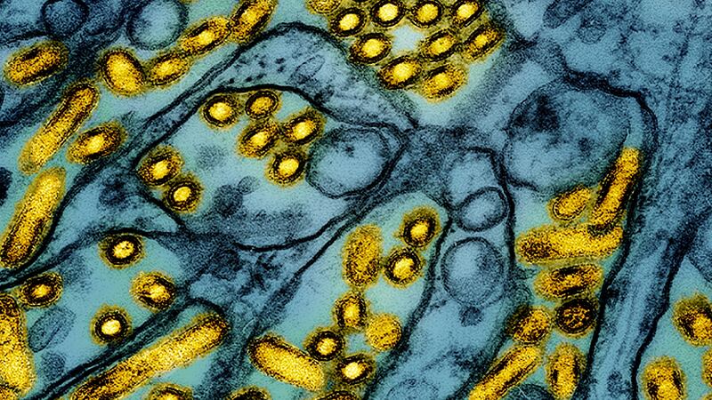 FILE -This colorized electron microscope image released by the National Institute of Allergy...