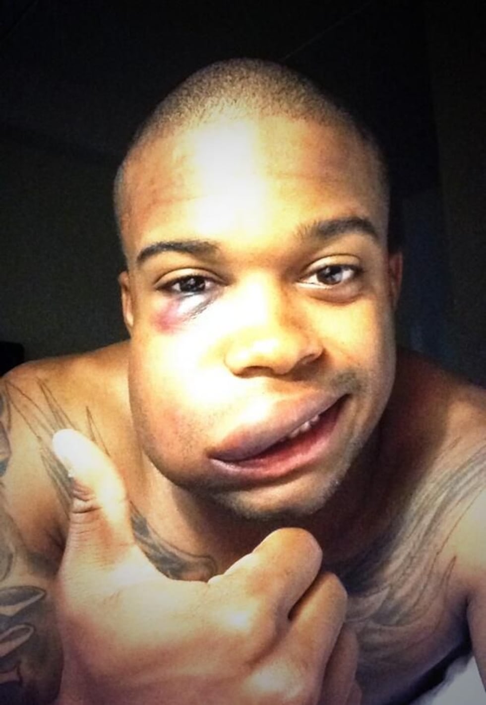 Baseball Player Hit in Face: Shocking Moments and Safety Tips